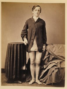 G. közlegény. W. Warrington, felépülés, amputáció nélkül, a jobb térdkalács lőtt törése után, a Sebészeti Szekció fényképkatalógusából.
