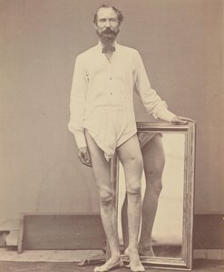 A bal combcsont középső harmadának lőtt sebe, 1865-67.