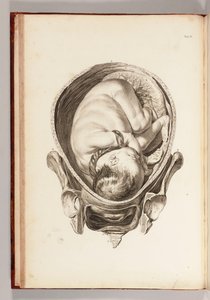 Egy gyermek vésése az anyaméhben az "Anatómiai táblázatok készletéből, magyarázatokkal és kivonattal, a szülésznői gyakorlatról", 1754