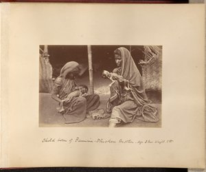 Éhínség sújtotta anya gyermeke - Kor: 3 hónap, Súly: 3 font. alkotó: Willoughby Wallace Hooper