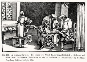 Egy német sebész, Boethius filozófiai vigasztalásából, illusztráció a Tudomány és irodalom középkorban és reneszánszban, írta és metszett Paul Lacroix, 1878 (bw ph