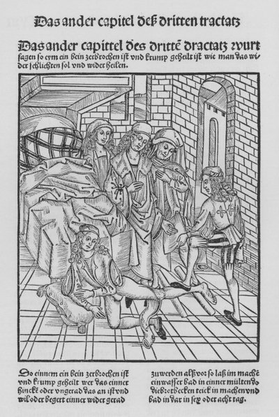 Hieronymus Brunschwig Cirurgia könyve (litho) alkotó: (after) German School