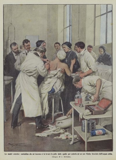 A hős anyák, egy parasztasszony, akinek Anconában levették a bőrét a válláról, hogy a sajátjának adják? alkotó: Achille Beltrame