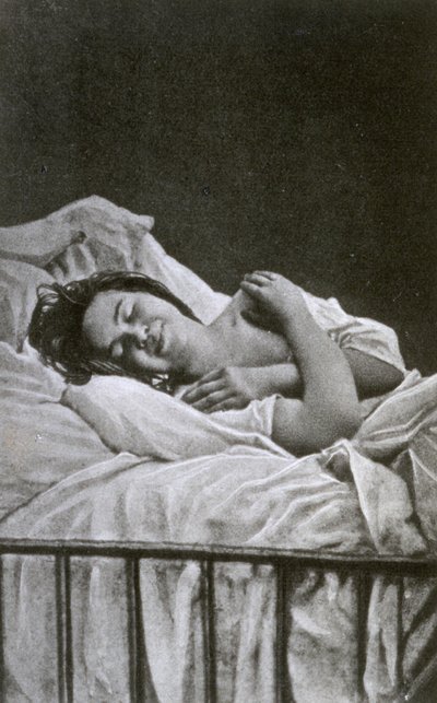 Fiatal nő hisztériás rohamban, 1878 alkotó: Albert Londe