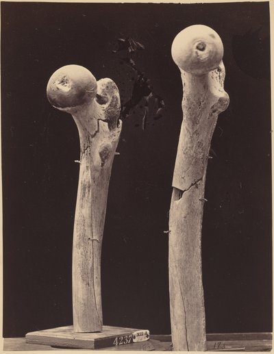 A combcsont lőtt töréseinek mintái,c. 1867 (fénykép) alkotó: American Photographer