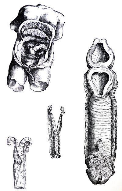 A lemezek a De Humani Corporis Fabrica ötödik könyvéből alkotó: Andreas Vesalius
