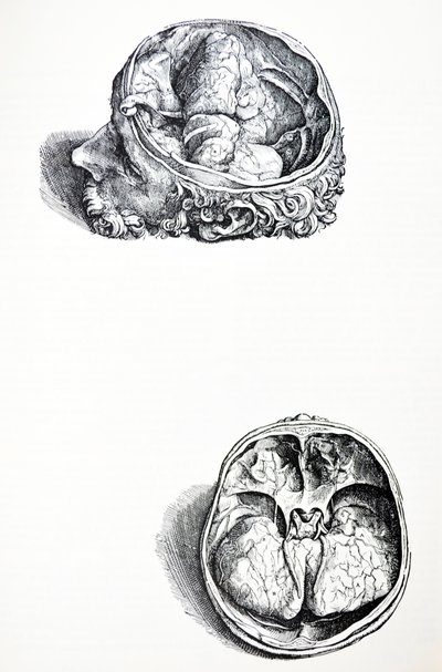 A De Humani Corporis Fabrica hetedik könyvének táblái alkotó: Andreas Vesalius