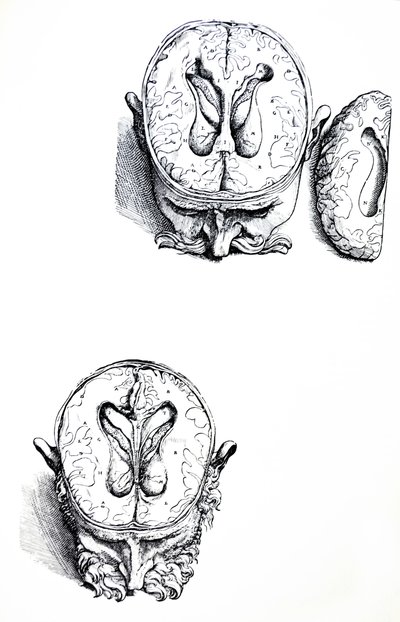A tányérok a De Humani Corporis Fabrica hetedik könyvéből alkotó: Andreas Vesalius
