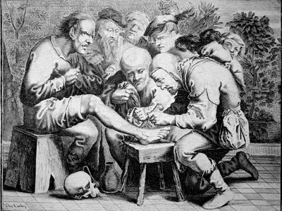 Bokaműtét (gravírozás alkotó: Anonymous Anonymous