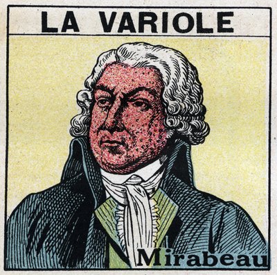 Honore Gabriel (Honore-Gabriel) Riqueti, Mirabeau grófjának (1749-1791) portréja himlős arccal. A himlő okozta hegek elkerülése érdekében a betegeket szobákban kell kezelni, vagy csak vörös, ultraibolya sugárzástól mentes fénybe kell belépni. Névtelen bete alkotó: Anonymous Anonymous