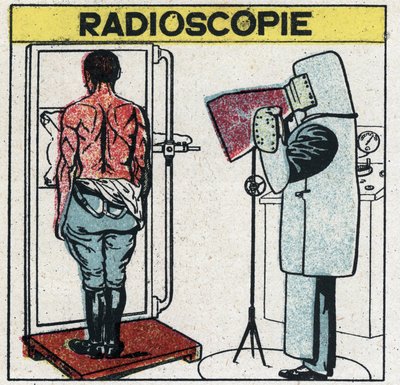 Röntgen: az emberi test röntgenfelvétele. A radiológus úgy védi magát a röntgensugaraktól, hogy ólomsókat tartalmazó gumioldatú gumikendőt visel, fejét sapkával, kezeit ugyanabból a szövetből készült kesztyűvel, szeme pr. alkotó: Anonymous Anonymous