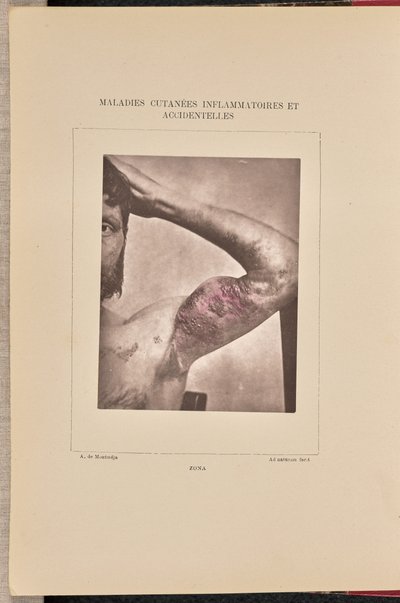 Zóna alkotó: Arthur de Montmeja