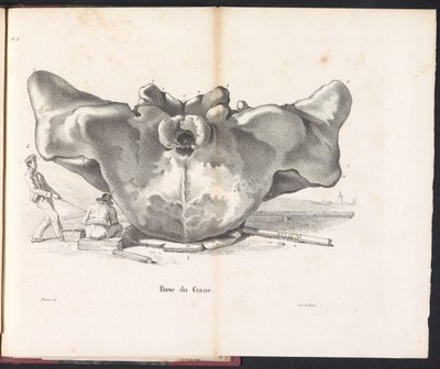 Bálnakoponya, 1827 Base du Crane (cím az objektumon) alkotó: Bossuet