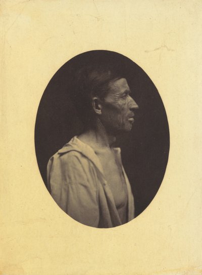 Egy 42 éves, alkoholfogyasztástól elkábított férfi profilképe..., 1854-1856. alkotó: Duchenne de Boulogne