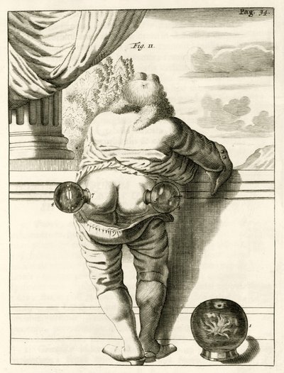Egy példa a köpölyözésre, Frederik Dekkers The Practice of Medicine című könyvéből, 1694 alkotó: Dutch School