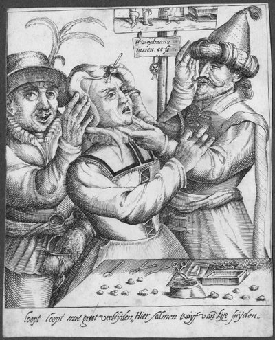 Trepanning, H. Weydmans metszete (XVI. század) alkotó: Dutch School