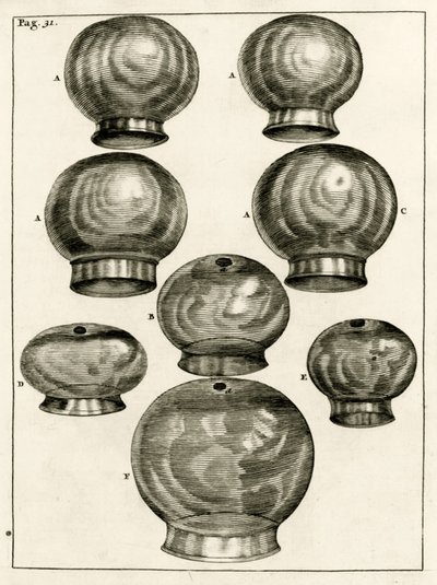 Különféle köpölyözéses poharak, Frederik Dekkers: Az orvostudomány gyakorlata, 1694 alkotó: Dutch School