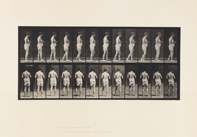 542. lemez. Cerebro-spinalis sclerosis multiplex - járás alkotó: Eadweard Muybridge