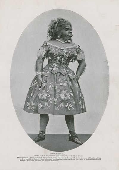 Julia Pastrana alkotó: English Photographer