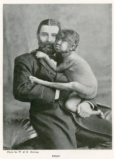 Krao, The Missing Link, kiállítva a londoni Westminster Aquariumban 1887-ben alkotó: English Photographer