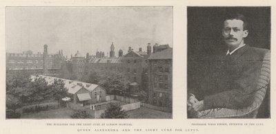 Alexandra királynő és a lupusz fénygyógyszere alkotó: English Photographer