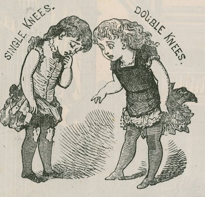 Gyermek dupla térdharisnya hirdetése alkotó: English School
