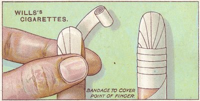 Finger Bandage, 50. sz. a Willss Cigarettes kártya elsősegély-sorozatából, 1913 alkotó: English School