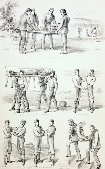 A sérültek szállításának módjai, 1890 körül alkotó: English School