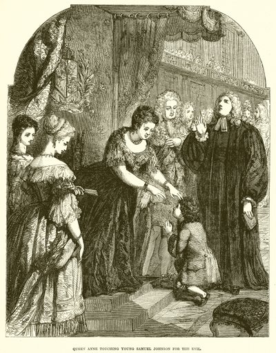 Anna királynő megérintette a fiatal Samuel Johnsont a gonoszért alkotó: English School