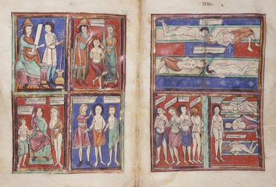 Sloane 1975 fol.91v-92 Orvosi jelenetek alkotó: English School