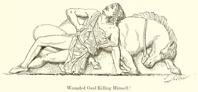 A sebesült Gall öngyilkos lett alkotó: English School