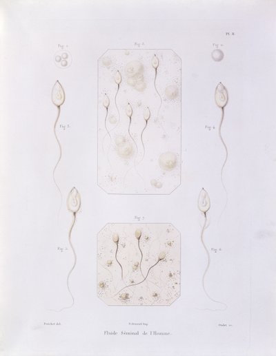 Seminális folyadék, Theorie Positive de lOvulation Spontanee et de la Fecondation des Mammiferes et de lEspece Humaine, Felix-Archimede Pouchet (1800-72) vésette Oudet, Párizs, 1847 (színes eng. alkotó: Felix-Archimede Pouchet