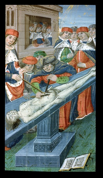 Ms Hunter 9 10r Dissection, De Medina Fen I. II, Avicenna (980-1037) alkotó: Flemish School