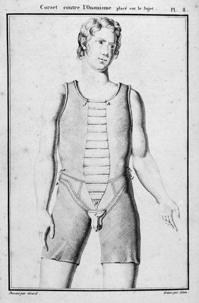 Fűző az onanizmus megelőzésére, illusztráció a Traite des bandages et devices, J.B.J. Thillaye, Párizs, 1815-ben jelent meg alkotó: French School