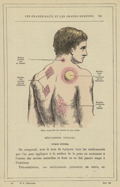 A leggyakoribb riasztószerek (színes litho) összehasonlító hatásai alkotó: French School