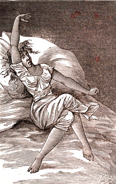 Fejfájás, melankólia és hisztéria, szorongás. 1887 (metszet) alkotó: French School