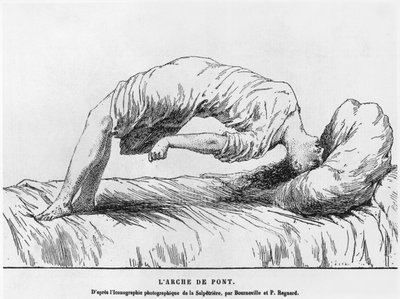 Hisztéria és somnambulizmus, Paul Regnard (1850-1927) Les Maladies Epidemiques de lEsprit című művéből, 1884 alkotó: French School