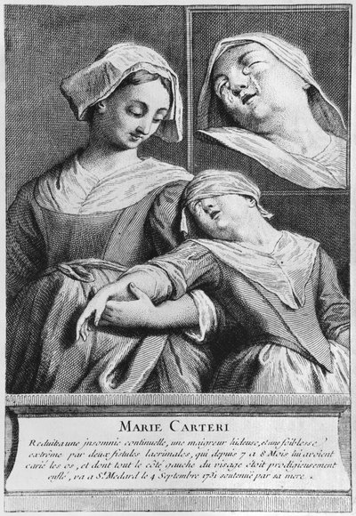 Egy vak nő, Marie Carteri csodálatos gyógyulása Francois de Paris diakónus sírján a párizsi Saint-Medard plébánia temetőjében alkotó: French School