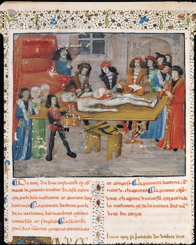 Ms H 184 fol.14v Boncolási lecke a montpellier-i orvosi karon, Guy de Chauliac "La Grande Chirurgie" című művéből, 1363. alkotó: French School