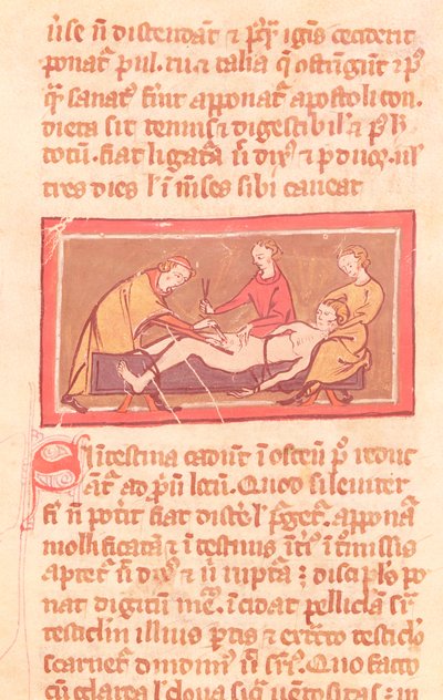 Ms H 89 fol.23 Surgery, Rogier de Salerne Sebészeti Könyvének egyik kiadásából alkotó: French School