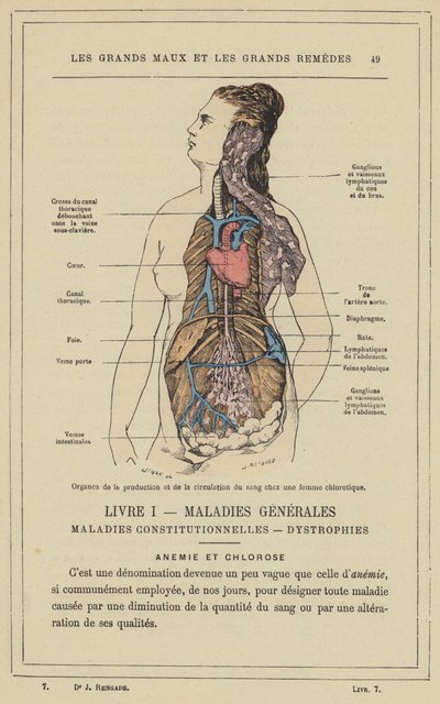Vértermelő és keringési szervek klorotikus nőben (színes litho) alkotó: French School