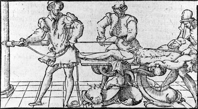 A diszlokáció csökkentése, „Ambroise Paré orvosi szerződése”, 1560 körül. alkotó: French School