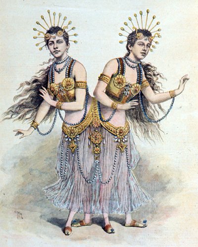 Sziámi ikrek, Rosa – Josepha Blazek a "Le Petit Journal"-ból, Párizs, 1891. április 8. (metszet) alkotó: French School
