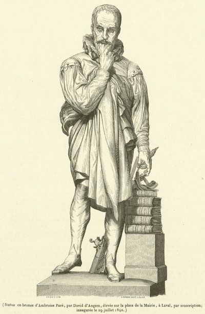 Ambroise Pare bronz szobra (metszet) alkotó: French School