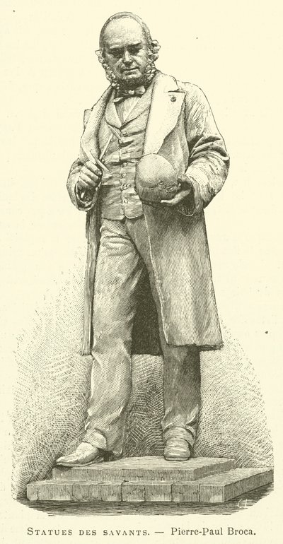 Tudósok szobrai, Pierre-Paul Broca (metszet) alkotó: French School
