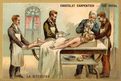 Trepanning (chromolitho) alkotó: French School