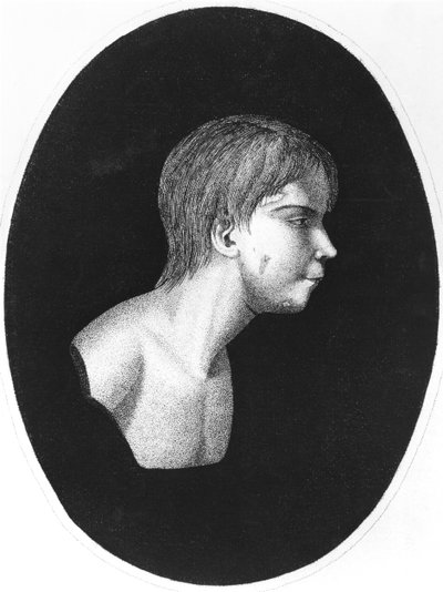 Victor of Aveyron, a De lEducation dun homme sauvage előlapja, J.E.Itard alkotó: French School