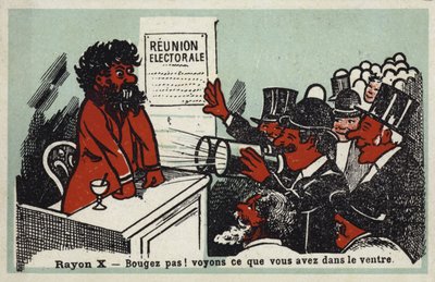 Röntgen - Ne mozduljon! Lássuk, mi van a gyomrában alkotó: French School