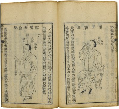 Shen Shi Yao Han A szemészet értékes könyve, 1644 alkotó: Fu Renyu