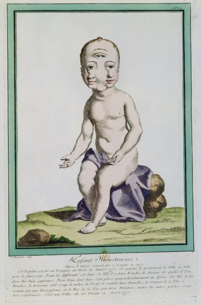 Gyermek deformált fejjel, a Les Ecarts de la Nature-ből, Párizs, 1775 alkotó: Genevieve Regnault de Nangis
